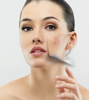 Cara menghilangkan bekas luka pada wajah