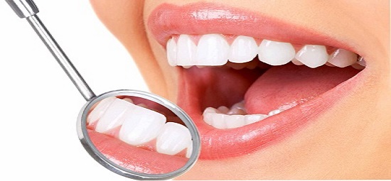 Inilah 3 Cara Menghilangkan Karang Gigi Secara Alami