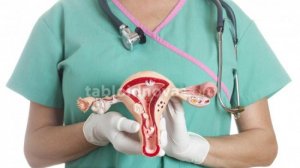 Perbedaan Antara Mioma, Kista, dan Endometriosis