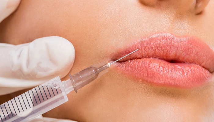 7-efek-menggunakan-lips-injection-yang-perlu-dipertimbangkan