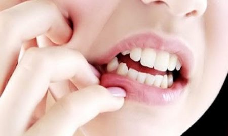 Herbal Ampuh untuk Mengobati Infeksi Gigi dan Sakit Gigi
