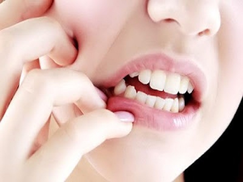 Herbal Ampuh untuk Mengobati Infeksi Gigi dan Sakit Gigi