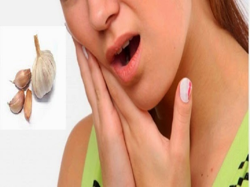 Obat Alami untuk Sakit Gigi Paling Ampuh
