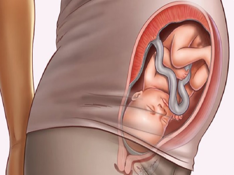 Tanda-tanda Kehamilan Sudah Dekat Dengan Persalinan