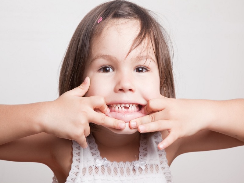 perawatan kesehatan gigi untuk anak berkebutuhan khusus