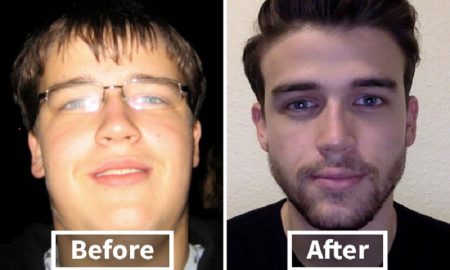 alasan mengapa diet ketat merubah penampilan wajah