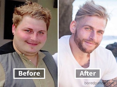 alasan mengapa diet ketat merubah penampilan wajah.3